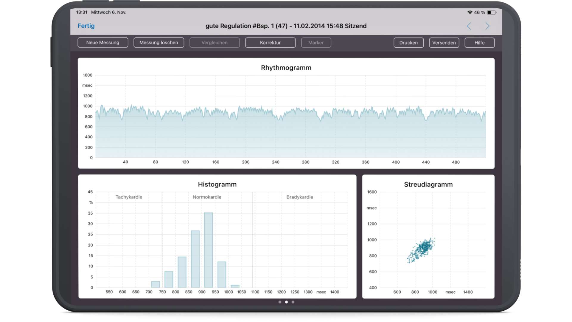 VNS-Analyse: Rhythmogramm, Histogramm und Streudiagramm einer Messung