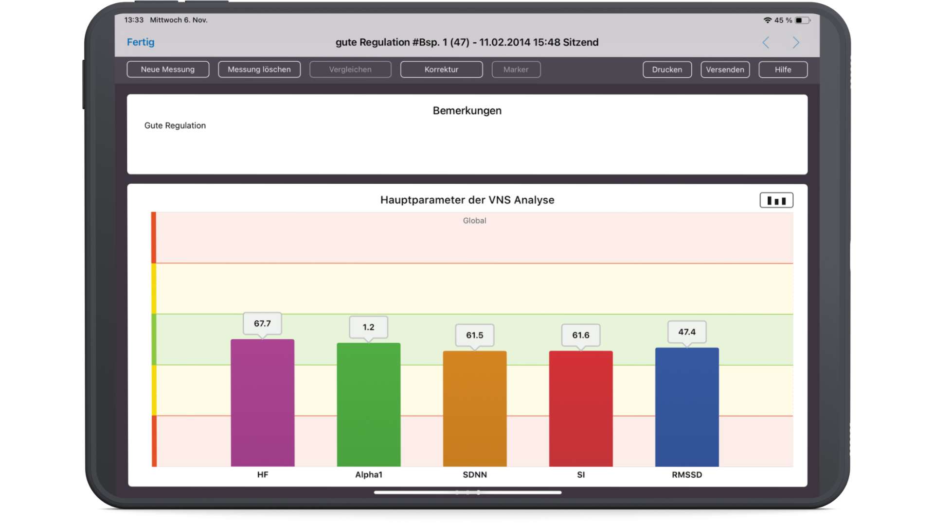 VNS-Analyse: Hauptparameter RMSSD, SDNN, Alpha-1 und Stressindex